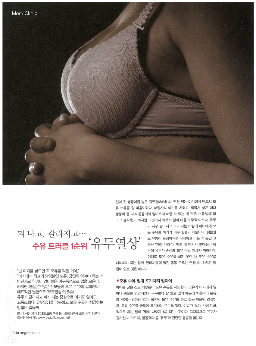피 나고, 갈라지고... 수유 트러블 1순위 '유두 열상'